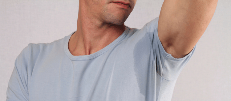 Botox for underarm sweat