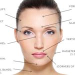 How Much Botox Do I Need?