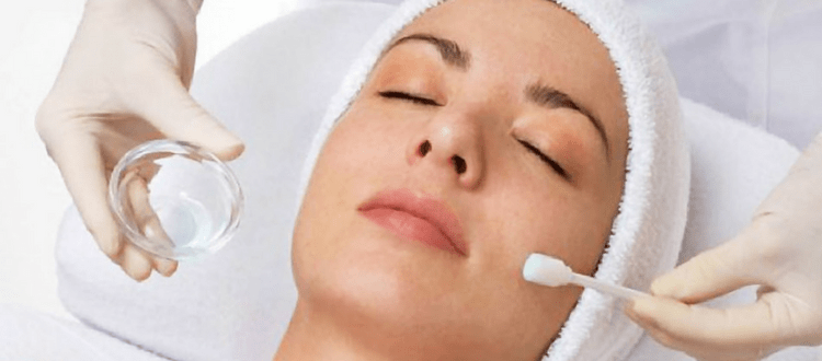 What to expect from chemical peels