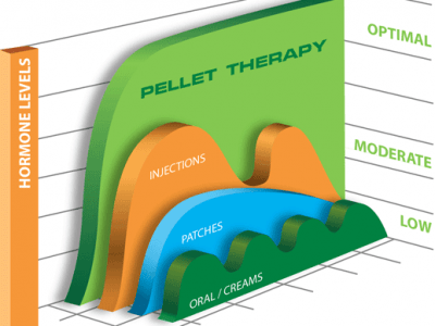chart pellet therapy