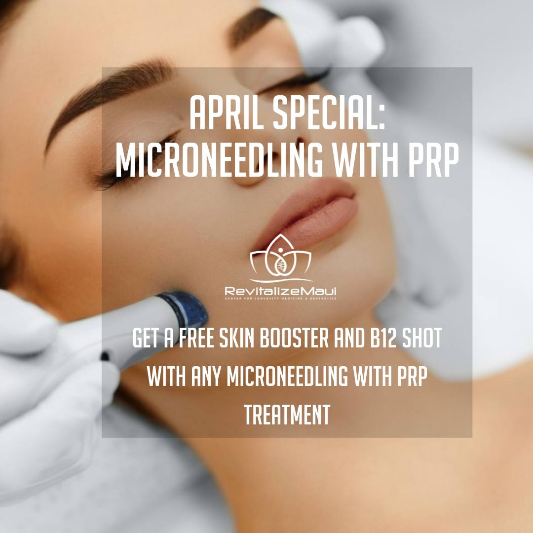 APRIL SPECIAL: MICRONEEDLING WITH PRP