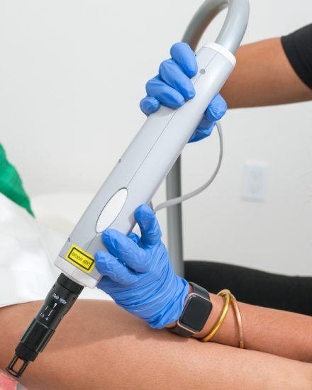 Laser Tatoo removal on Maui