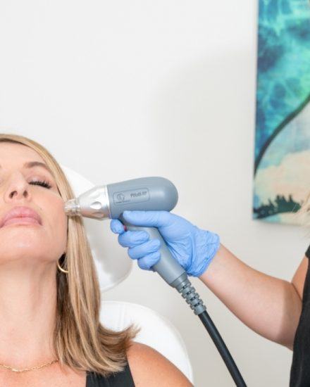 Pixel8 RF Microneedling Treatment at RevitalizeMaui