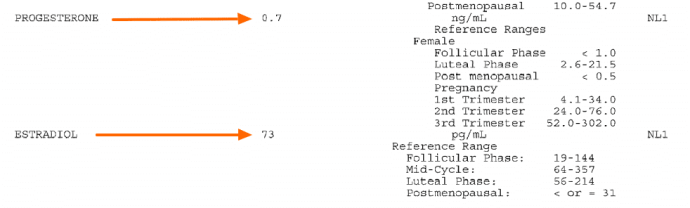 Low progesterone symptoms labs