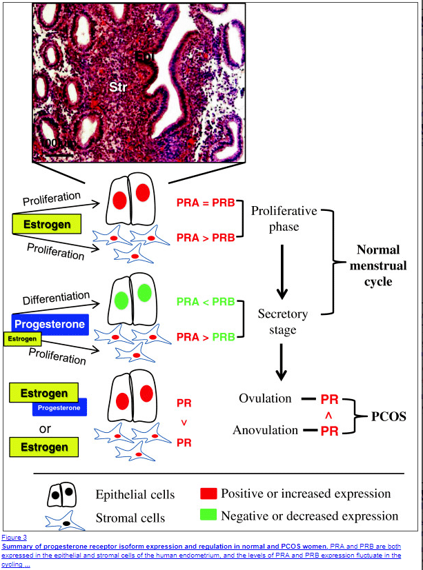 Progesterone resistance