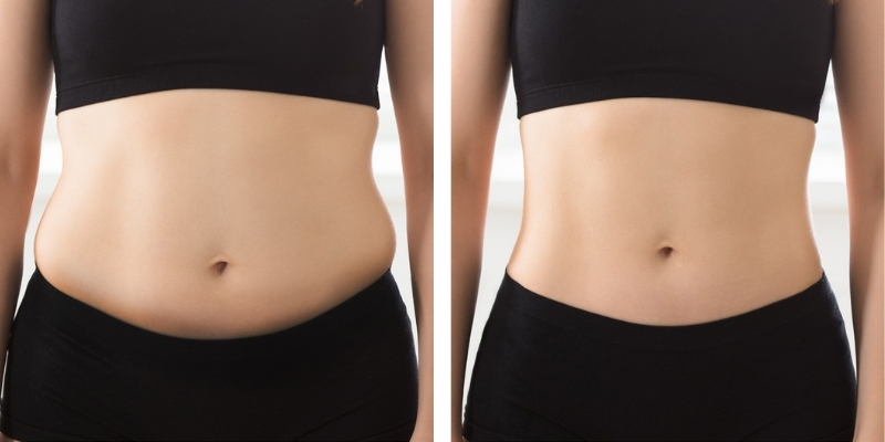 BodyTone Muscle Toning Before & After