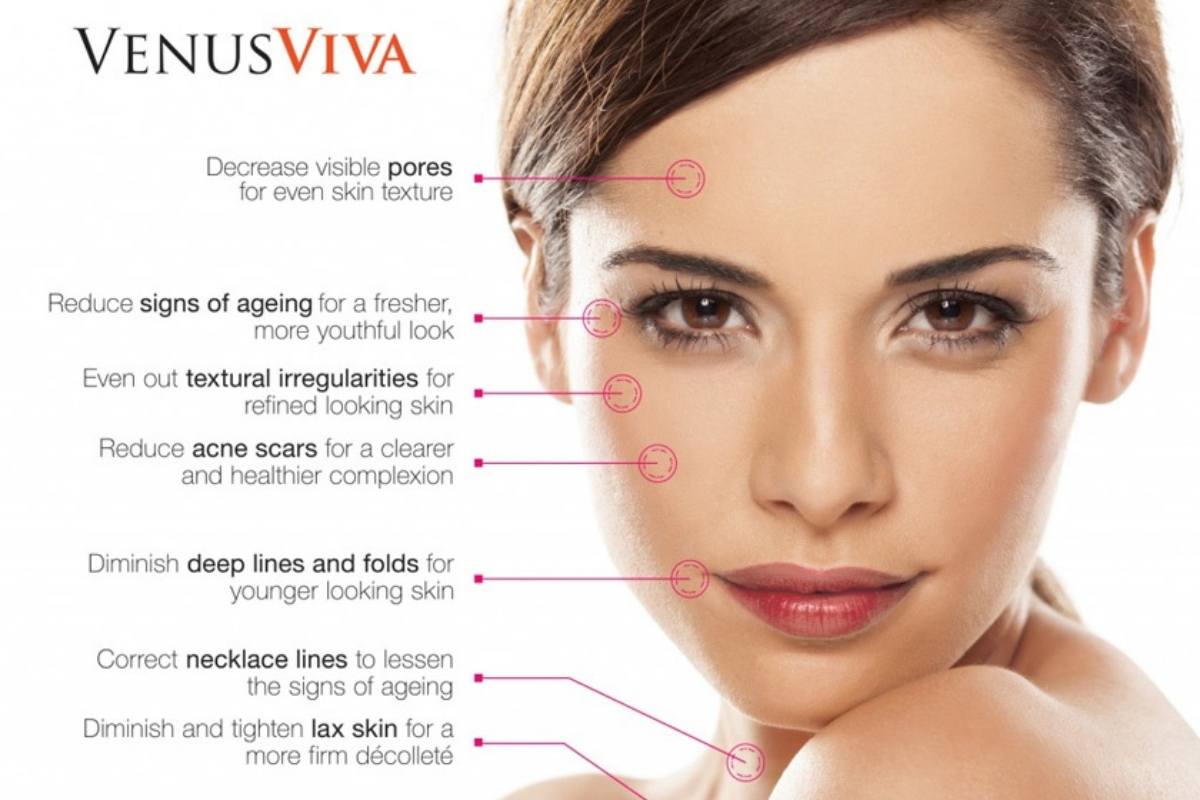 Venus Viva Skin Resurfacing on Maui