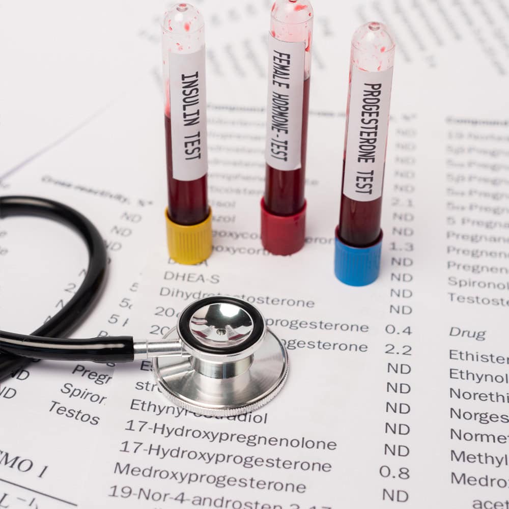 Ongoing BHRT Monitoring For Perimenopause